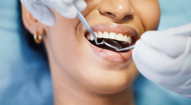 Best Walk-In Emergency Dental Services in Harpersville, AL