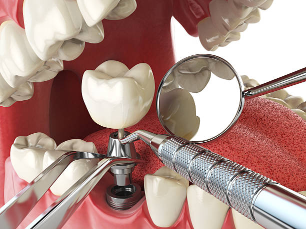 Best Emergency Cosmetic Dentistry (e.g., broken veneers) in Harpersville, AL